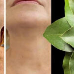 El Laurel: El Secreto Natural que Supera al Botox para Combatir Arrugas