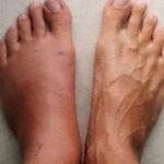 7 Señales que Tu Cuerpo Te Avisará un Mes Antes de Sufrir un Infarto