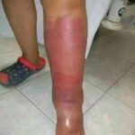Los Primeros Síntomas de Estrés y Cómo Aliviarlos con Remedios Naturales
