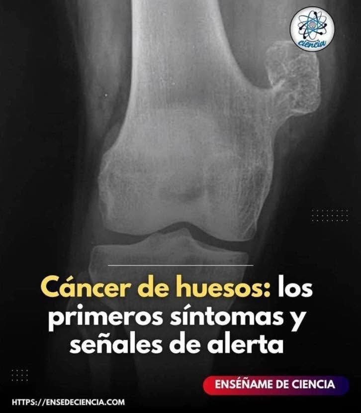 Radiografía de un hueso humano