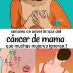 Síntomas para Detectar Cáncer de Mama: Lo Que Debes Saber