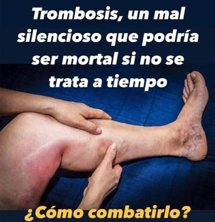 Trombosis y síntomas