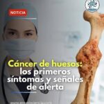 Alerta de Salud: Reconoce los Primeros Síntomas del Cáncer de Huesos
