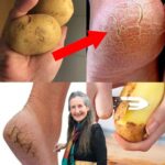 Elimina los Talones Agrietados: Consejos y Remedios Naturales