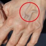 Remedios Naturales para Mejorar la Salud de tus Venas y Piel