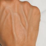 Venas Visibles en las Manos: Un Indicador de Salud y Remedios Naturales