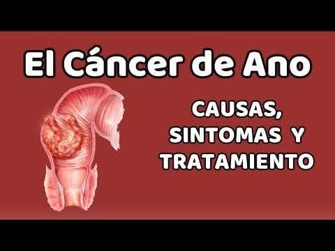 Cáncer de Ano