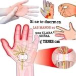 ¿Por Qué Se Te Duermen Las Manos? Causas y Remedios Caseros