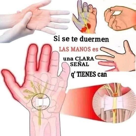 Anatomía de la mano y nervios