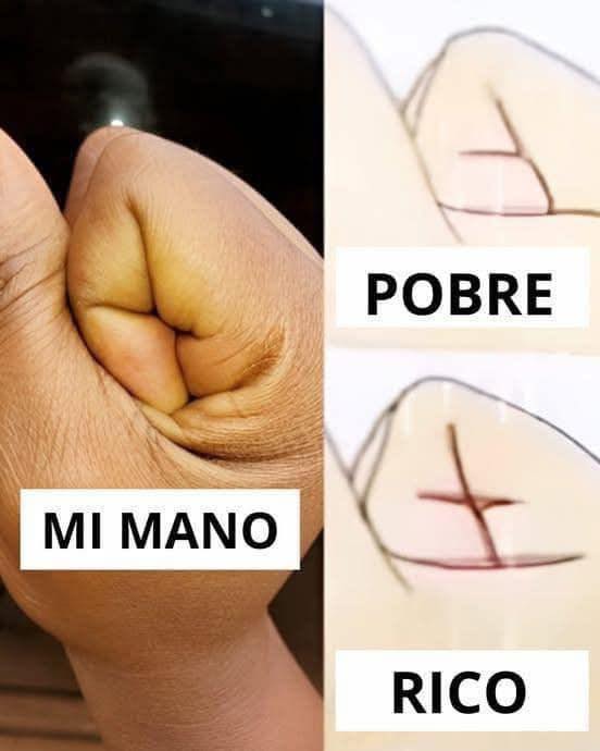 Humor sobre las manos y la riqueza