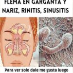 Remedios Caseros para Eliminar Moco, Flema y Rinitis