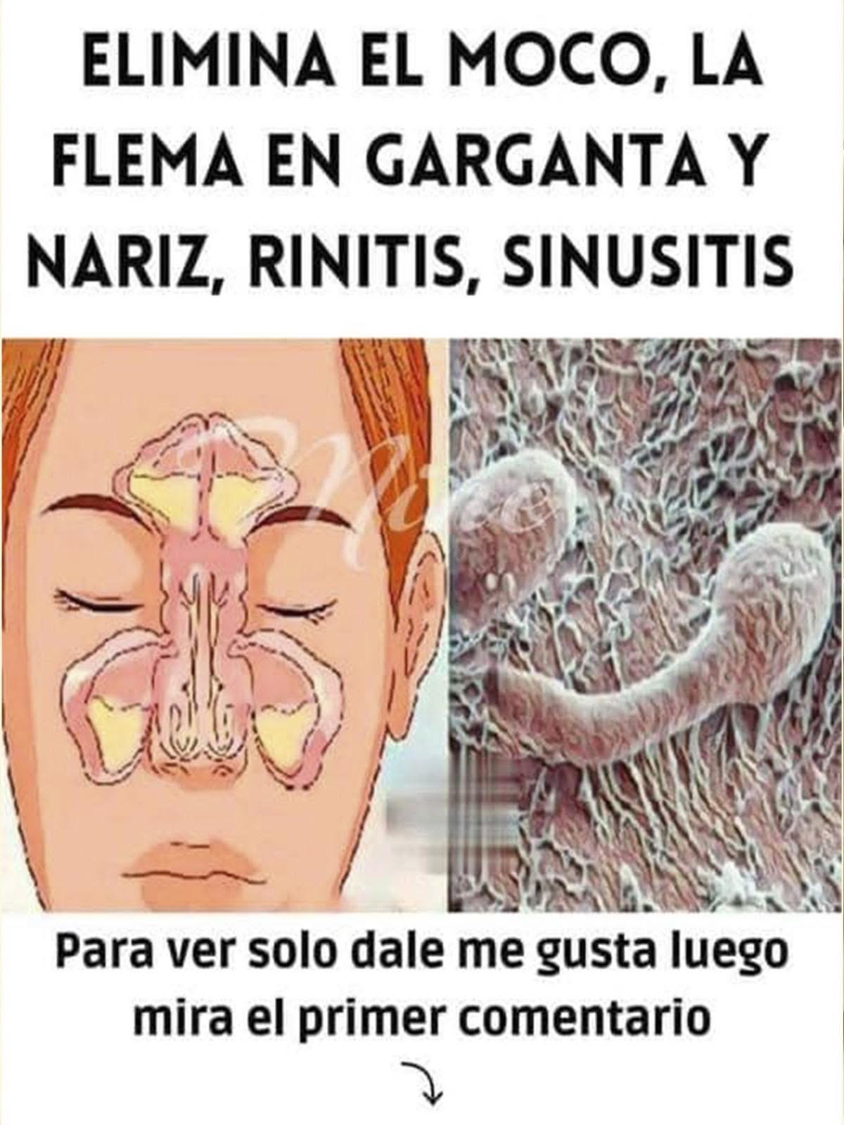 Diagrama de senos nasales y estructura relacionada con el moco