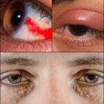 Señales Oculares: Lo que tus Ojos Pueden Revelar Sobre tu Salud