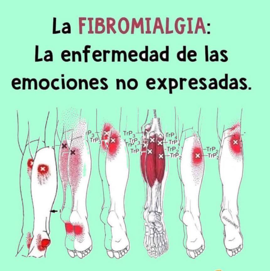Ilustración sobre la fibromialgia