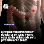 Los Síntomas del Cáncer de Colon: Lo Que Necesitas Saber