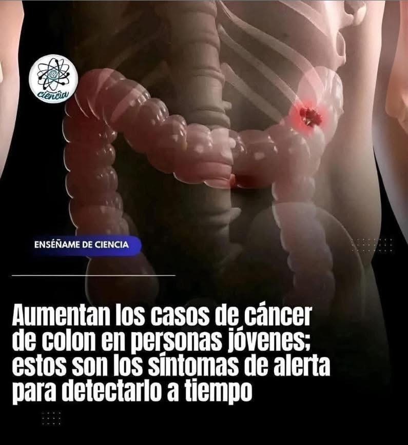 Síntomas del cáncer de colon