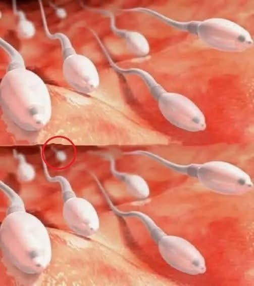 Representación Gráfica de Espermatozoides y Óvulo