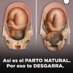 Dar a Luz Sin Anestesia: Una Experiencia Transformadora