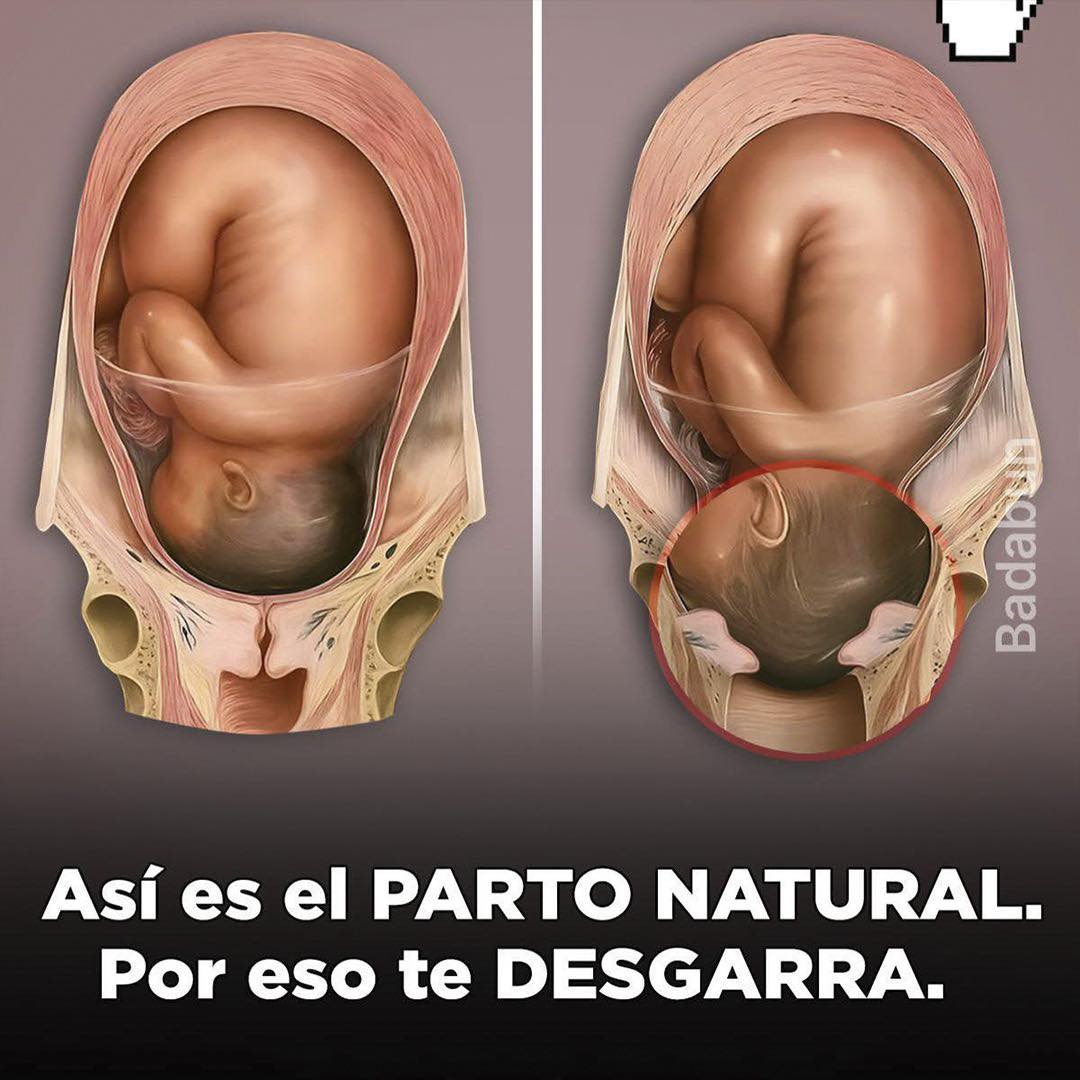 Ilustración anatómica del parto natural