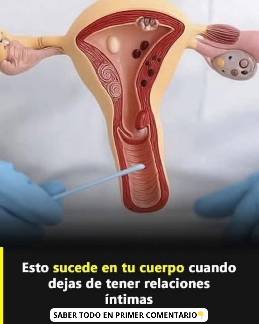Sistema Reproductor Femenino