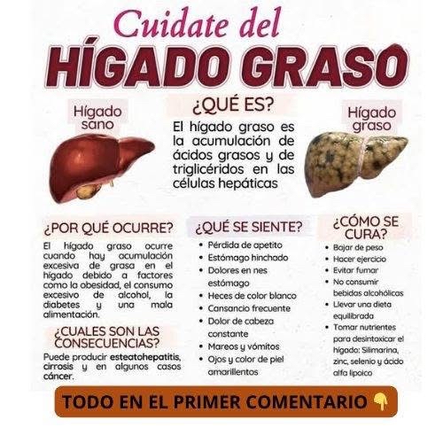 Infografía sobre Hígado Graso