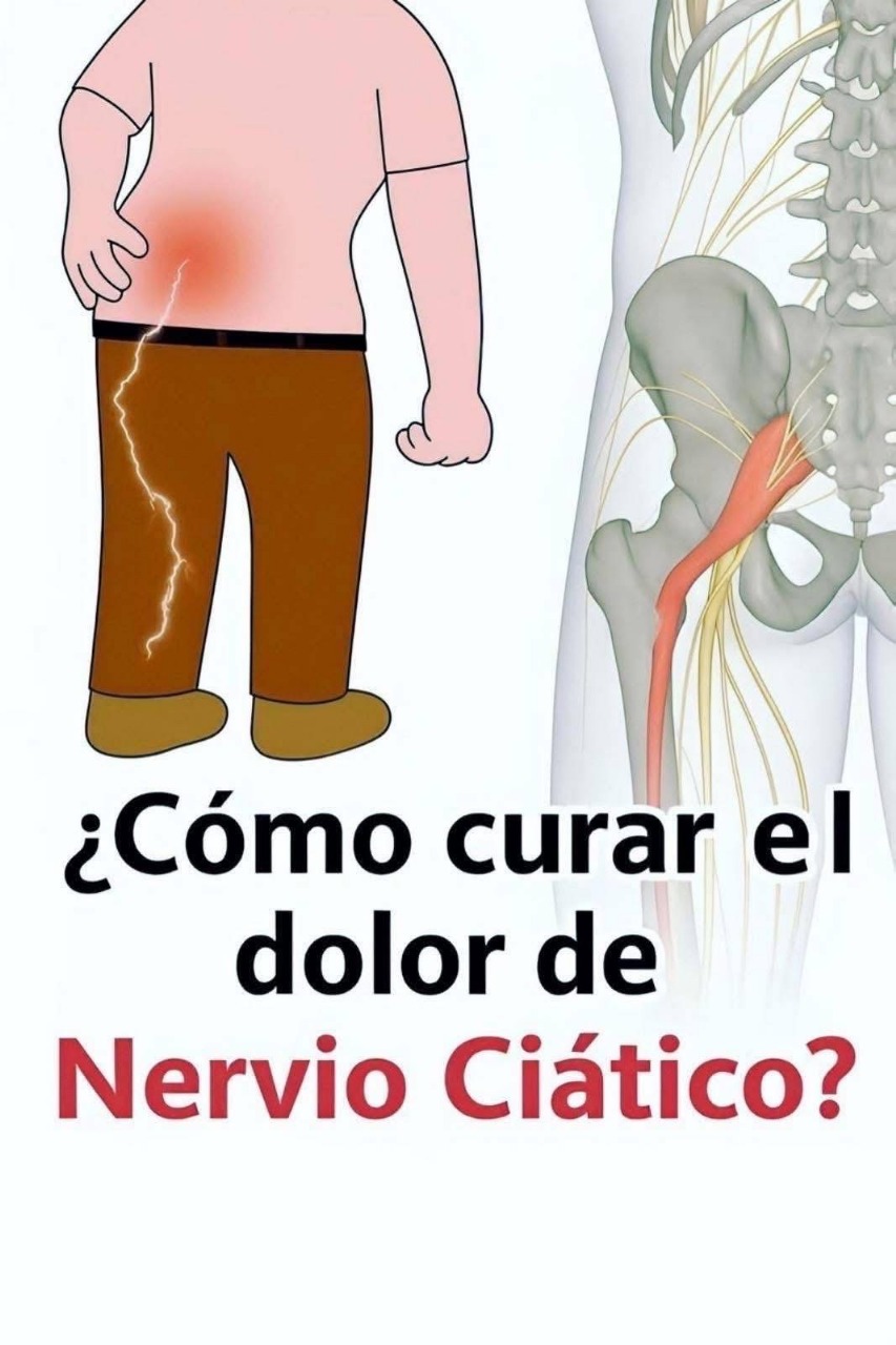 Dolor Nervio Ciático