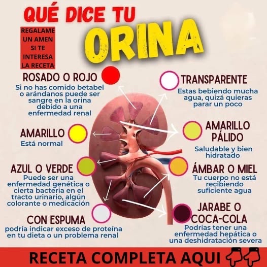 Infografía sobre el color de la orina y su significado
