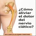 Cómo Aliviar el Dolor del Nervio Ciático: Remedios Naturales Efectivos
