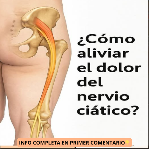 Ilustración del nervio ciático en el cuerpo humano