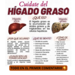 Hígado Graso: Reconoce los Síntomas y Reviértelo a Tiempo