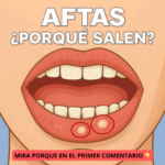 ¿Por Qué Salen las Aftas? Las Señales Dolorosas que No Debes Ignorar