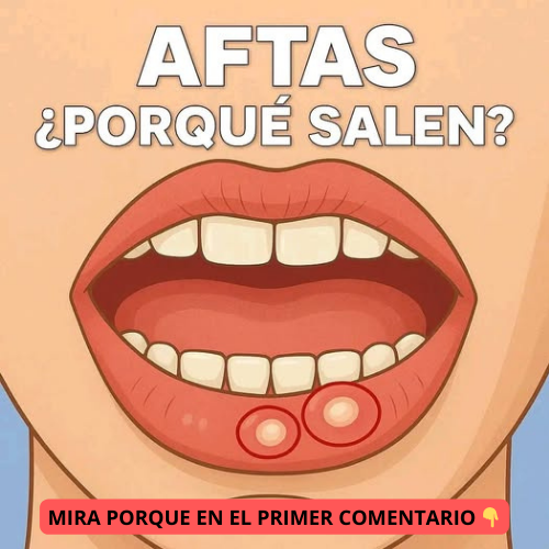 Aftas en la boca