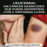 Leucemia: Reconocer los Síntomas Silenciosos y Prevenir Complicaciones