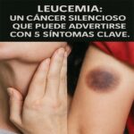 Leucemia: Reconociendo el Cáncer Silencioso a Través de 5 Síntomas Clave