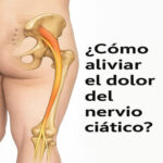 Cómo Aliviar el Dolor del Nervio Ciático: Remedios Naturales y Consejos Prácticos
