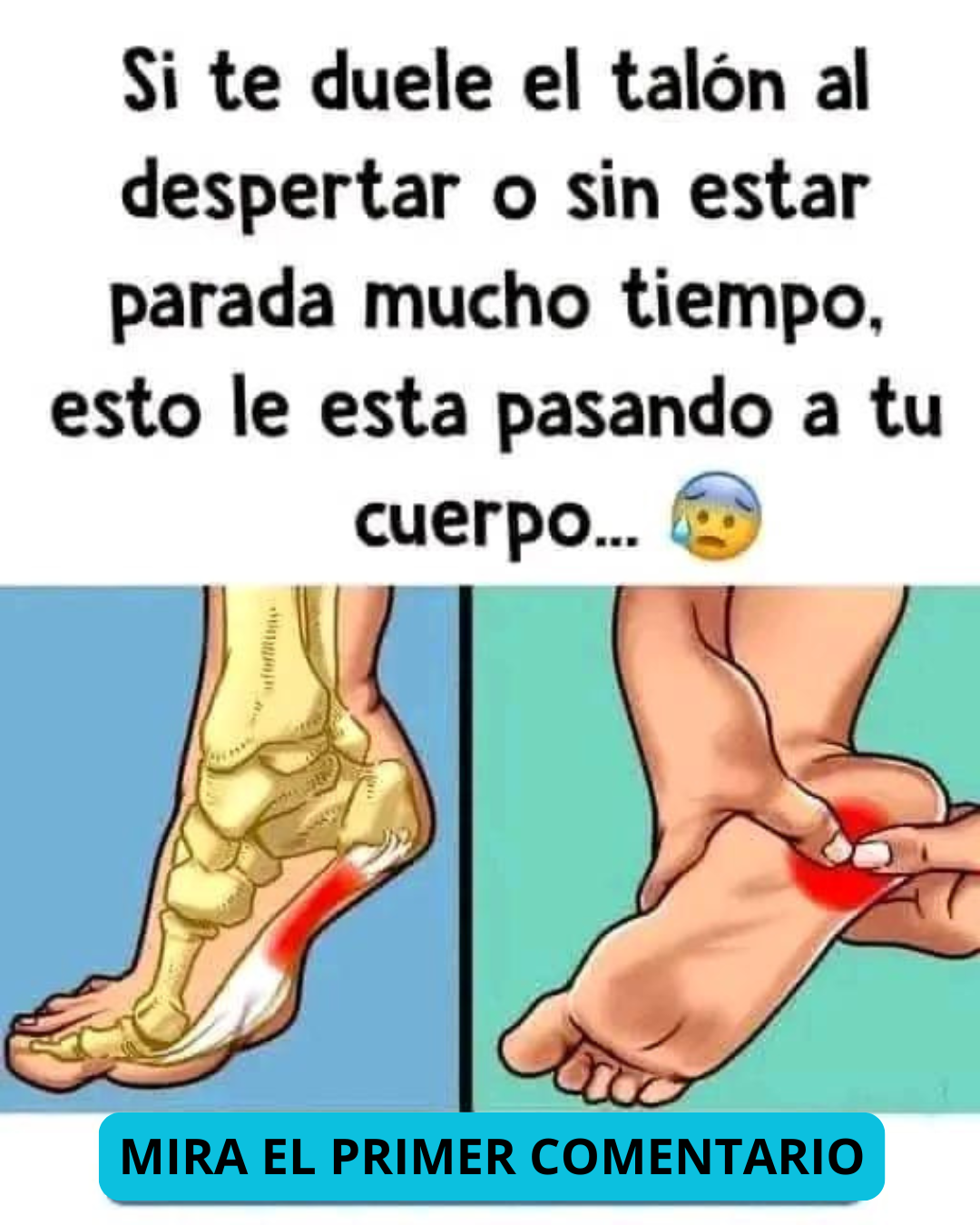 Diagrama sobre el dolor en el talón