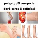 8 Señales de Advertencia de Problemas Renales