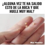 Cálculos o Tonsilolitos: Lo Que Necesitas Saber y Remedios Naturales