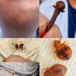 Cómo Combatir Infestaciones de Chinches con Remedios Naturales