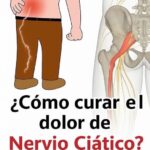 Adiós al Dolor: Técnicas Naturales para el Dolor de Nervio Ciático