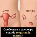 Impacto de la Histerectomía en el Cuerpo Femenino: Lo que Nadie te Cuenta