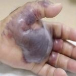 Las Consecuencias de Dormir con el Teléfono Móvil y Cómo Evitar Problemas de Salud