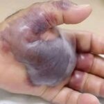 Descubre las Consecuencias de Dormir con Muchachos: Salud y Remedios Naturales