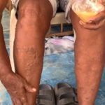El Cura Pie: El Remedio Natural que Combate la Artritis y Mejora tu Salud