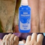 Descubre los Beneficios del Agua Oxigenada para Tratar Manchas y Arrugas en el Rostro