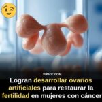 Ovarios Artificiales: Esperanza para la Fertilidad Después del Cáncer