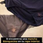 Manchas en la Ropa Interior: ¿Qué Debes Saber Sobre la Salud?