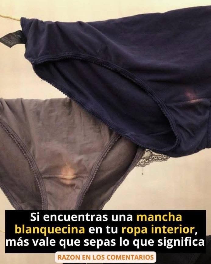 Ropa interior con manchas