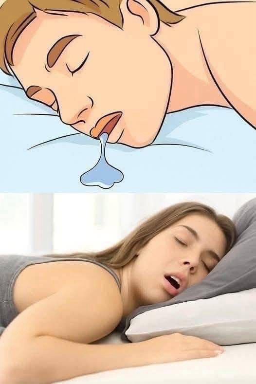 Persona durmiendo boca abajo y babeando
