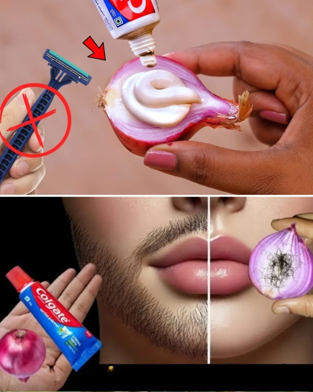 Remedio casero para el crecimiento de la barba